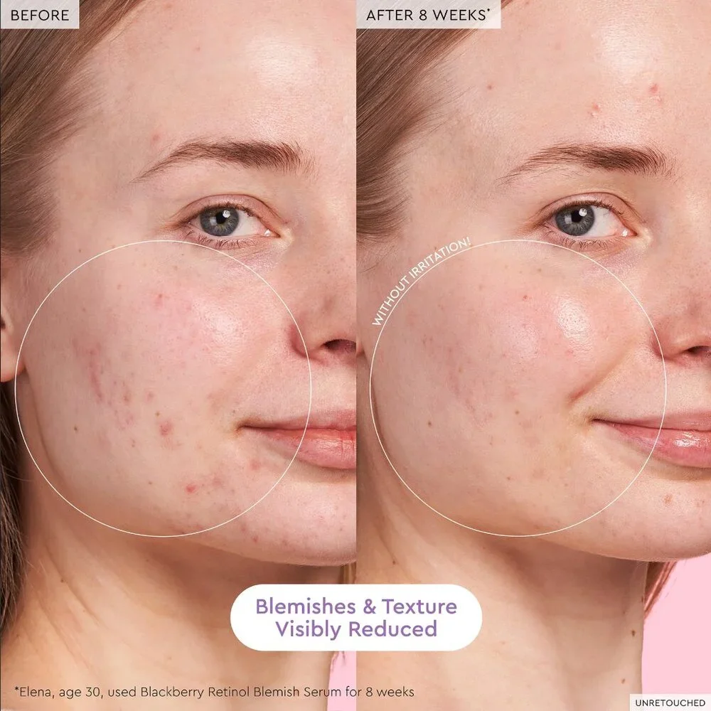 GLOW RECIPE BLACKBERRY RETINOL BLEMISH SERUM